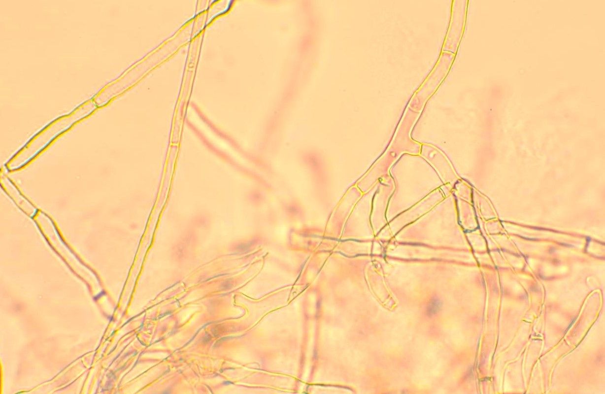 Sợ nấm Rhizoctonia solani soi dưới kính hiển vi