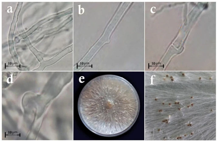 Hình ảnh sợi nấm, hạch nấm nuôi cấy trên môi trường nhân tạo, và hình ảnh hiển vi